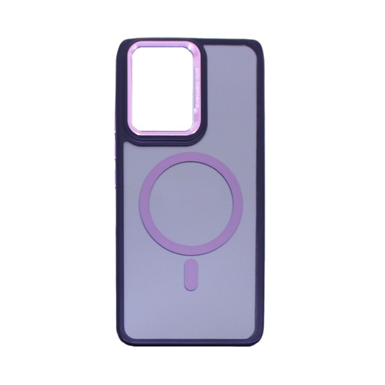 Capa Duro Designer Magnética para Oppo Reno13 F Rosa